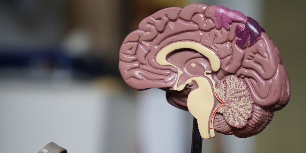 Neurodegenerative-Disease